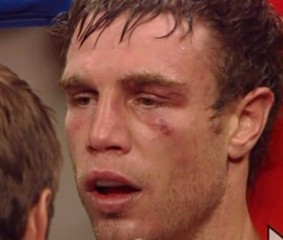 Michael Katsidis