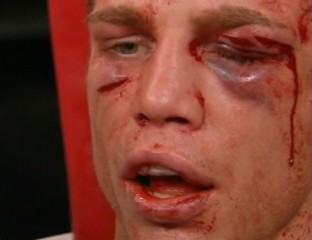 katsidis vs casamayor