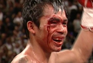 Manny Pacquiao