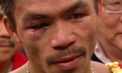 Manny Pacquiao