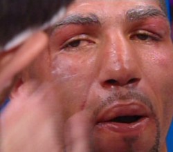 Winky Wright