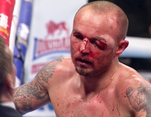 The Heart Of A Lion : Is There A Way Back For Kevin Mitchell?