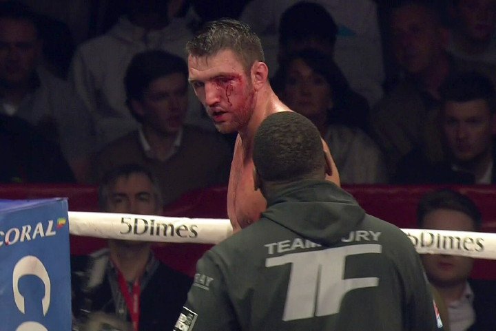 Hughie Fury says he'll one day do to Joshua what Ali did to Foreman