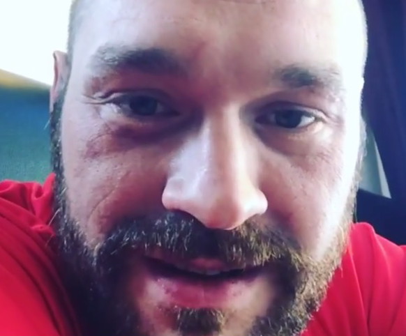 Tyson Fury: I opened up the whole division, never get any credit for it