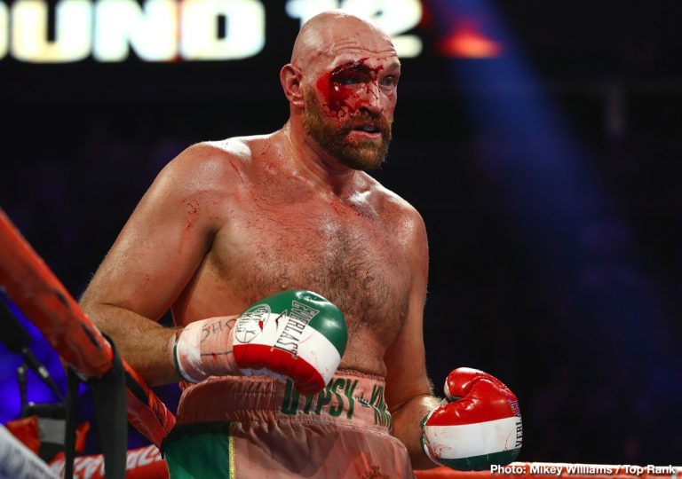 Crawford says Fury fight would have been stopped if it was someone else