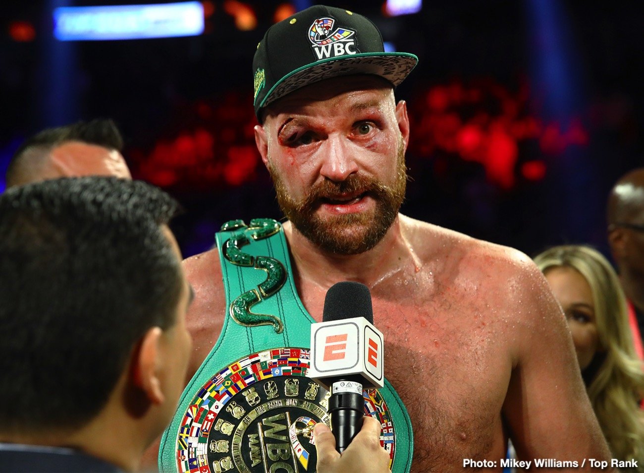 How Do Tyson Fury's Nasty Cuts Rate On The 'Klitschko-ometer?'