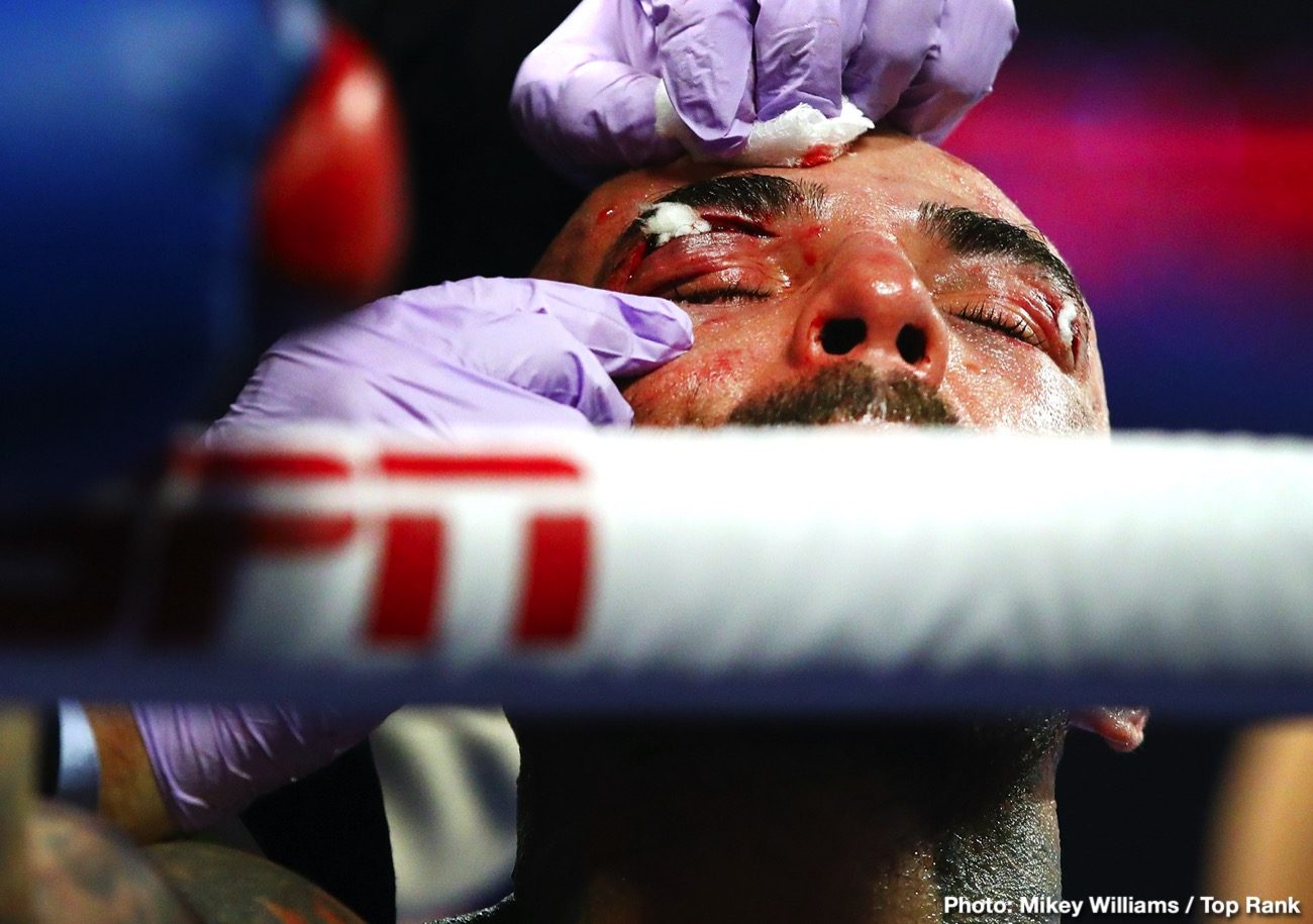 Boxing photo: Artur Beterbiev, Luis Collazo, Oleksandr Gvozdyk image RESULTS: Artur Beterbiev KOs Oleksandr Gvozdyk