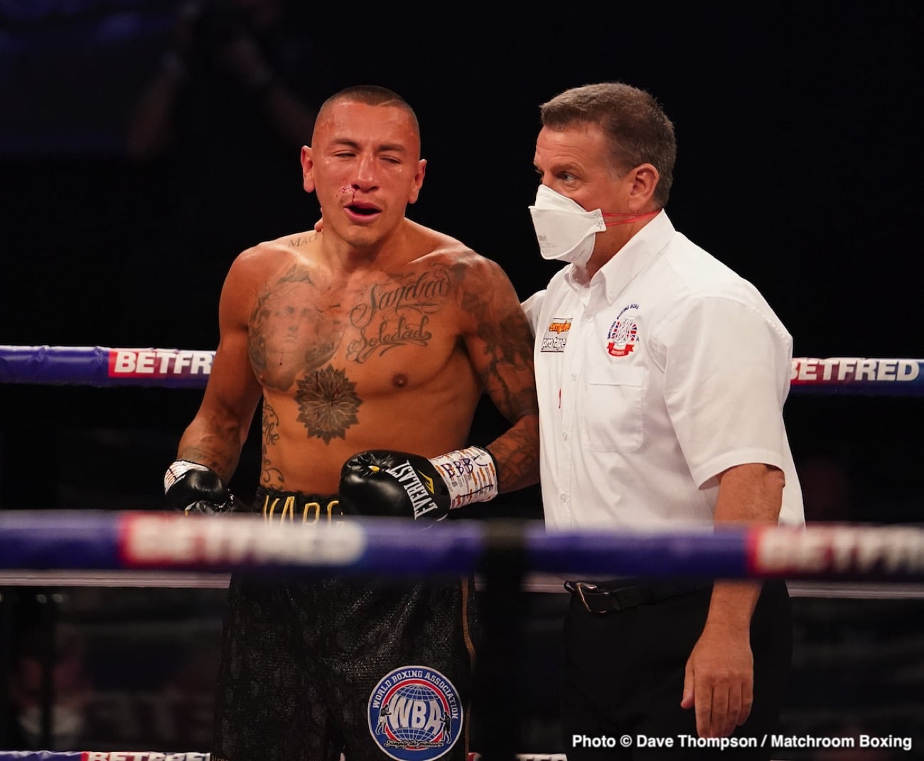 Samuel Vargas says stoppage was "stupid"