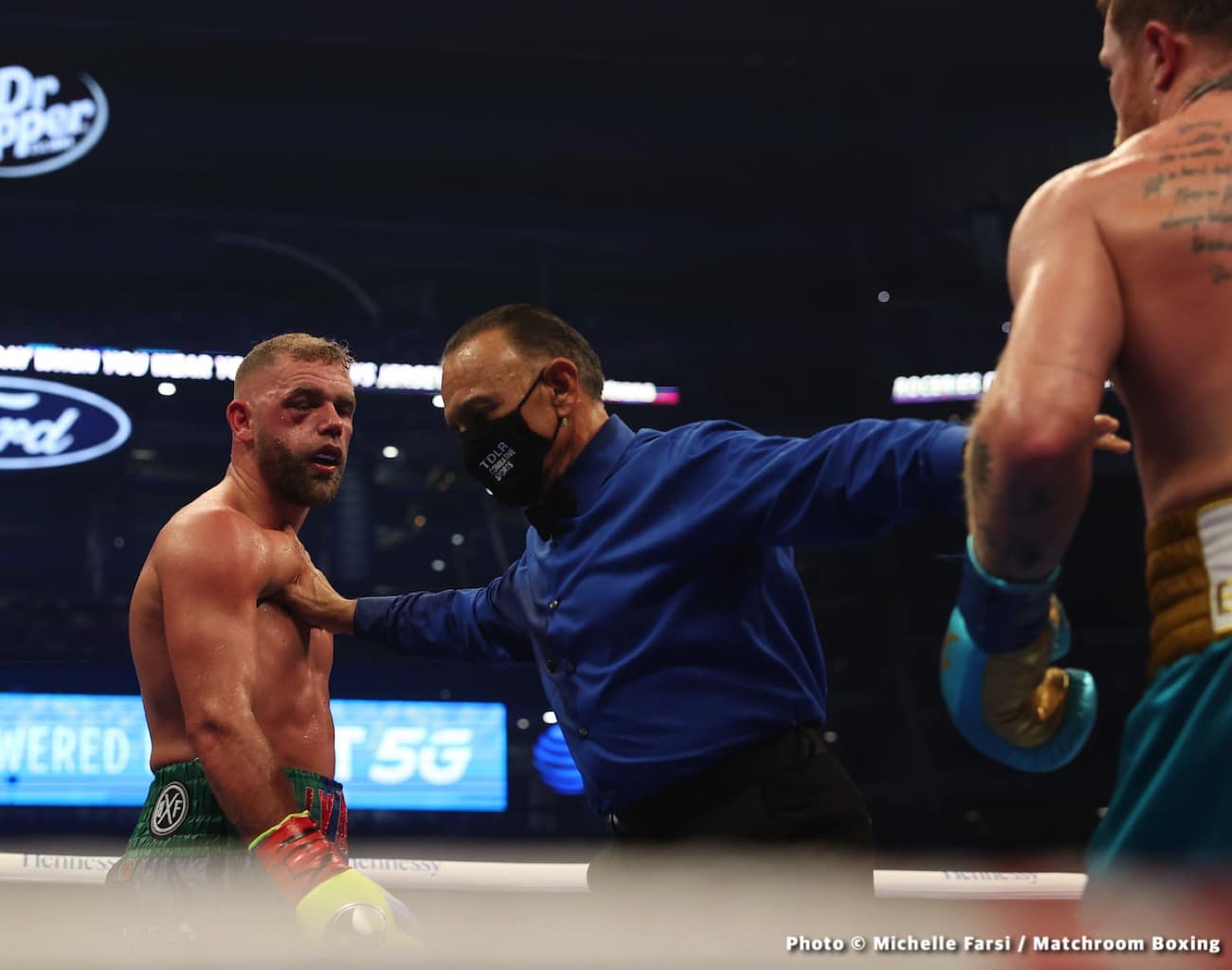 Eddie Hearn: Saunders has a triple fracture of eye orbital, surgery today