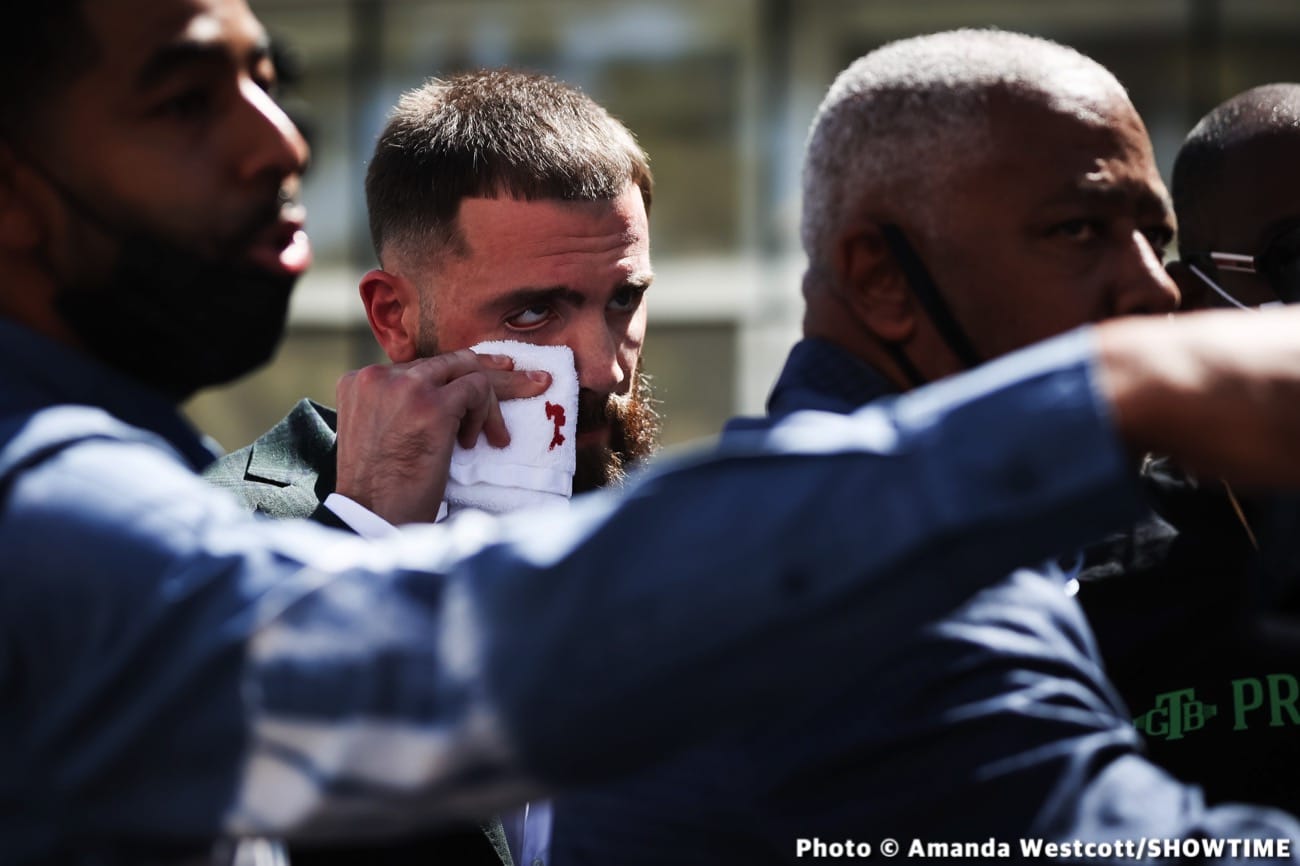 Caleb Plant suffers big gash under eye after Canelo Alvarez slugs him