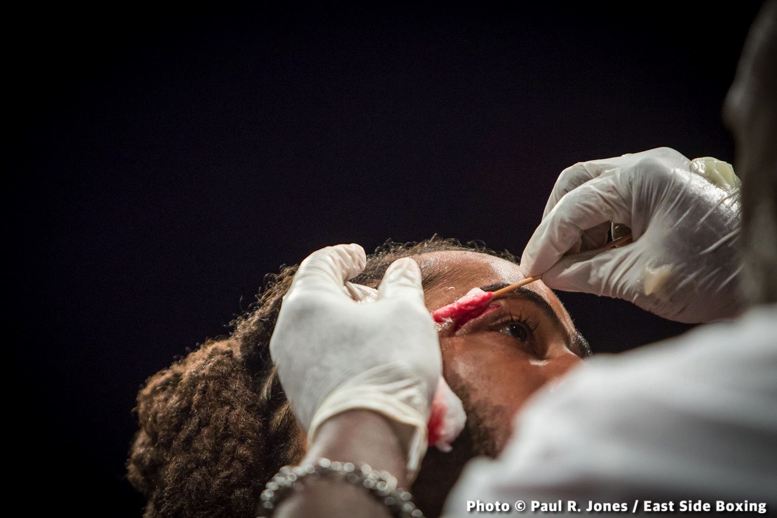 WEEKEND RECAP: Anthony Peterson Wins, Outlaw Suffers Setback. Here’s What It Means in 3 Takeaways — Prograis, Taylor, Catterall, More!
