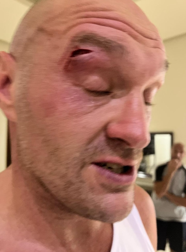 Tyson Fury CUT in sparring by Agron Smakici - watch leaked video!
