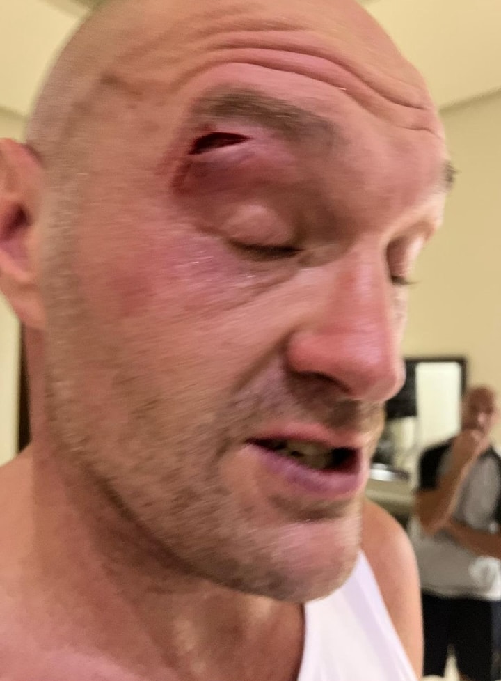 Fury - Usyk Fight OFF! Fury Cut In Training!