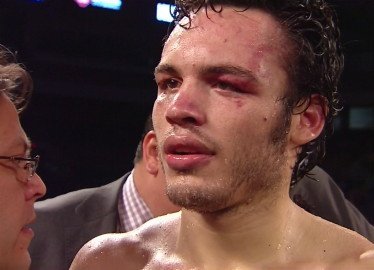 Chavez Jr Calling People Out Already??? "Desperate" To Redeem Himself?