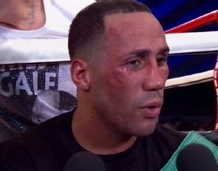 DeGale: 'I Want Badou Jack Unification Next Year'