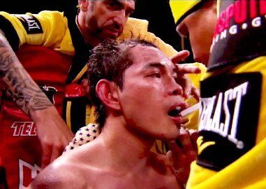 Robert Garcia: “Nonito Donaire is a real Champion who doesn’t duck anyone”