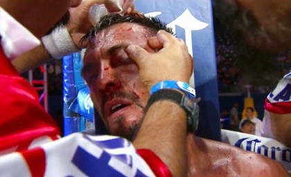 Guerrero prevails over Kamegai in a Potential Fight of the Year Guerrero vs. Kamegai Robert Guerrero Boxing News Boxing Results