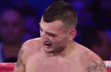 Martirosyan-Lara ruled a technical draw; Garcia stops Barros